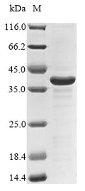 (Tris-Glycine gel) Discontinuous SDS-PAGE (reduced) with 5% enrichment gel and 15% separation gel.