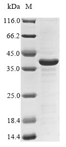 (Tris-Glycine gel) Discontinuous SDS-PAGE (reduced) with 5% enrichment gel and 15% separation gel.