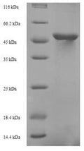 Recombinant Saccharomyces cerevisiae Probable tRNA threonylcarbamoyladenosine biosynthesis protein KAE1 (KAE1) – Figure 1 of 