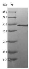 (Tris-Glycine gel) Discontinuous SDS-PAGE (reduced) with 5% enrichment gel and 15% separation gel.
