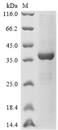 (Tris-Glycine gel) Discontinuous SDS-PAGE (reduced) with 5% enrichment gel and 15% separation gel.