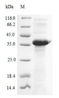 (Tris-Glycine gel) Discontinuous SDS-PAGE (reduced) with 5% enrichment gel and 15% separation gel.