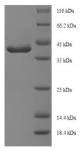 Recombinant Bacillus subtilis L-cystine-binding protein tcyA (tcyA) – Figure 1 of 1