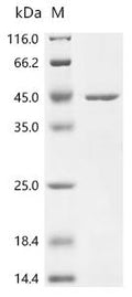 (Tris-Glycine gel) Discontinuous SDS-PAGE (reduced) with 5% enrichment gel and 15% separation gel.