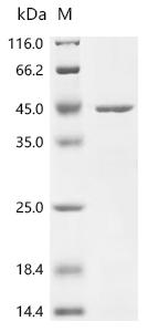 (Tris-Glycine gel) Discontinuous SDS-PAGE (reduced) with 5% enrichment gel and 15% separation gel.