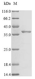 (Tris-Glycine gel) Discontinuous SDS-PAGE (reduced) with 5% enrichment gel and 15% separation gel.