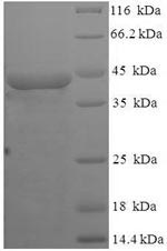 Recombinant Mycoplasma sp.Modification methylase MunI (munIM) – Figure 1 of 1
