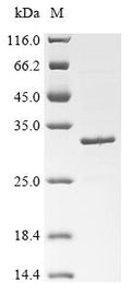 (Tris-Glycine gel) Discontinuous SDS-PAGE (reduced) with 5% enrichment gel and 15% separation gel.