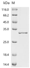 (Tris-Glycine gel) Discontinuous SDS-PAGE (reduced) with 5% enrichment gel and 15% separation gel.