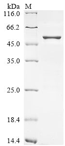(Tris-Glycine gel) Discontinuous SDS-PAGE (reduced) with 5% enrichment gel and 15% separation gel.