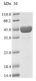 (Tris-Glycine gel) Discontinuous SDS-PAGE (reduced) with 5% enrichment gel and 15% separation gel.