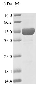 (Tris-Glycine gel) Discontinuous SDS-PAGE (reduced) with 5% enrichment gel and 15% separation gel.
