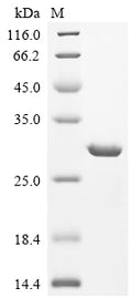 (Tris-Glycine gel) Discontinuous SDS-PAGE (reduced) with 5% enrichment gel and 15% separation gel.