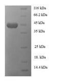 Recombinant Bacillus sp. Monomeric sarcosine oxidase (soxA) – Figure 1 of 1