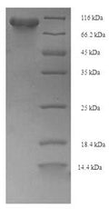 Recombinant Escherichia coli Phosphoenolpyruvate synthase (ppsA) – Figure 1 of 1