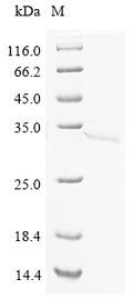 (Tris-Glycine gel) Discontinuous SDS-PAGE (reduced) with 5% enrichment gel and 15% separation gel.