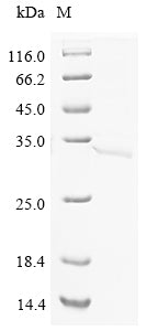 (Tris-Glycine gel) Discontinuous SDS-PAGE (reduced) with 5% enrichment gel and 15% separation gel.
