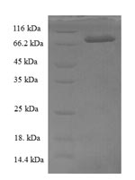 Recombinant Cucurbita maxima L-ascorbate oxidase (AAO) – Figure 1 of 1