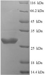 Recombinant Bovine coronavirus Spike glycoprotein (S), partial – Figure 1 of 1