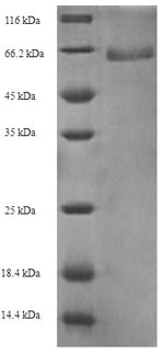 Recombinant Gardnerella vaginalis 5-1 Site-specific DNA-methyltransferase (adenine-specific) – Figure 1 of 1