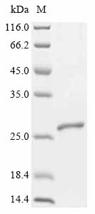 (Tris-Glycine gel) Discontinuous SDS-PAGE (reduced) with 5% enrichment gel and 15% separation gel.