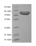 Recombinant Chlamydia pneumoniae Major outer membrane porin (ompA) – Figure 1 of 1