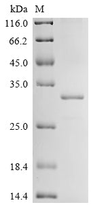 (Tris-Glycine gel) Discontinuous SDS-PAGE (reduced) with 5% enrichment gel and 15% separation gel.