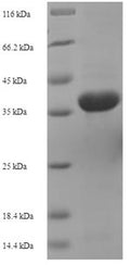 Recombinant Actinoplanes utahensis Aculeacin-A acylase (aac), partial – Figure 1 of 1
