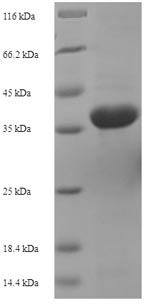 Recombinant Actinoplanes utahensis Aculeacin-A acylase (aac), partial – Figure 1 of 1