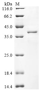 (Tris-Glycine gel) Discontinuous SDS-PAGE (reduced) with 5% enrichment gel and 15% separation gel.
