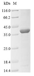 (Tris-Glycine gel) Discontinuous SDS-PAGE (reduced) with 5% enrichment gel and 15% separation gel.