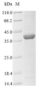 (Tris-Glycine gel) Discontinuous SDS-PAGE (reduced) with 5% enrichment gel and 15% separation gel.