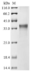 (Tris-Glycine gel) Discontinuous SDS-PAGE (reduced) with 5% enrichment gel and 15% separation gel.