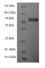 Recombinant Caenorhabditis elegans ATP-dependent (S)-NAD(P)H-hydrate dehydratase(R107.2) – Figure 1 of 1