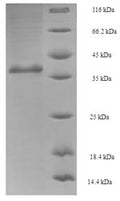 Recombinant Saccharomyces cerevisiae GTP-binding nuclear protein GSP1/CNR1 (GSP1) – Figure 1 of 1