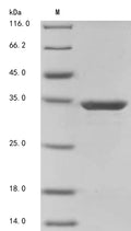 (Tris-Glycine gel) Discontinuous SDS-PAGE (reduced) with 5% enrichment gel and 15% separation gel.