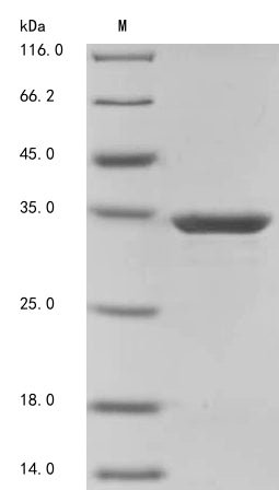 (Tris-Glycine gel) Discontinuous SDS-PAGE (reduced) with 5% enrichment gel and 15% separation gel.