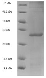 Recombinant Human papillomavirus type 52 Protein E6 (E6) – Figure 1 of 1