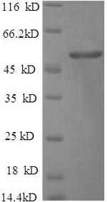 Recombinant Salmonella typhimurium Outer membrane porin protein OmpD (ompD) – Figure 1 of 1