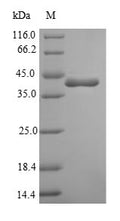 (Tris-Glycine gel) Discontinuous SDS-PAGE (reduced) with 5% enrichment gel and 15% separation gel.
