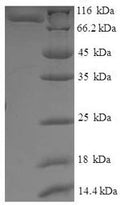 Recombinant Saccharomyces cerevisiae Translation initiation factor IF-2, mitochondrial (IFM1) – Figure 1 of 1