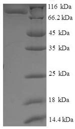 Recombinant Saccharomyces cerevisiae Translation initiation factor IF-2, mitochondrial (IFM1) – Figure 1 of 1
