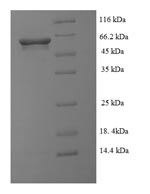 Recombinant Clostridioides difficile NAD-specific glutamate dehydrogenase (gluD) – Figure 1 of 1