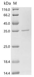 (Tris-Glycine gel) Discontinuous SDS-PAGE (reduced) with 5% enrichment gel and 15% separation gel.