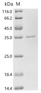 (Tris-Glycine gel) Discontinuous SDS-PAGE (reduced) with 5% enrichment gel and 15% separation gel.