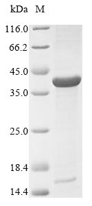 (Tris-Glycine gel) Discontinuous SDS-PAGE (reduced) with 5% enrichment gel and 15% separation gel.