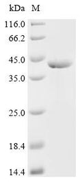 (Tris-Glycine gel) Discontinuous SDS-PAGE (reduced) with 5% enrichment gel and 15% separation gel.