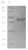 (Tris-Glycine gel) Discontinuous SDS-PAGE (reduced) with 5% enrichment gel and 15% separation gel.