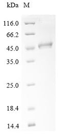 (Tris-Glycine gel) Discontinuous SDS-PAGE (reduced) with 5% enrichment gel and 15% separation gel.