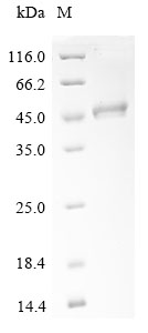 (Tris-Glycine gel) Discontinuous SDS-PAGE (reduced) with 5% enrichment gel and 15% separation gel.